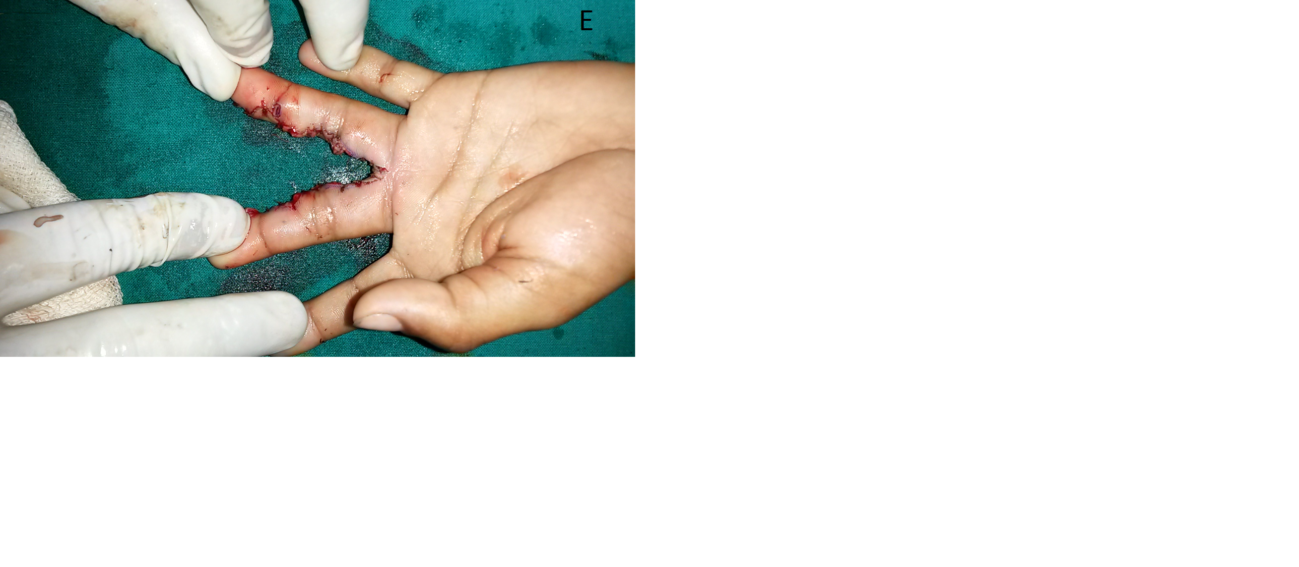 Pediatric Plastic Surgery Image 11